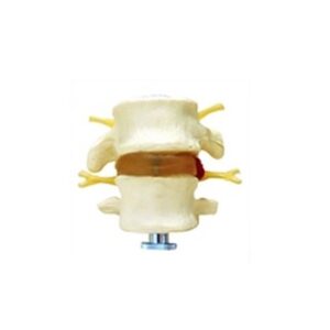 2 VERTEBRAS LOMBARES 2 PECAS