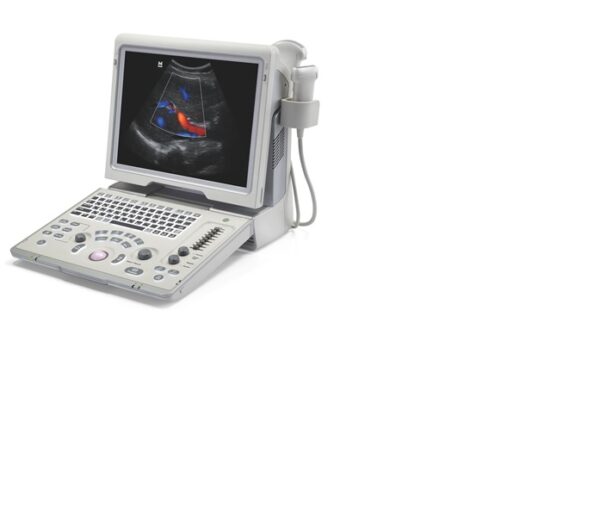 ULTRASONOGRAFIA PORTATIL